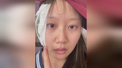 面瘫视频,从视频看面瘫的典型表现