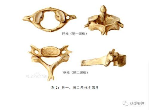 治疗颈椎病的视频
