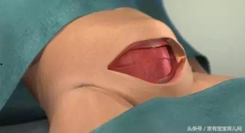 女人生孩子顺产视频