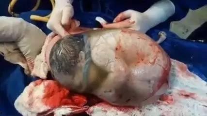 羊水破了的视频,真实记录生命诞生的震撼时刻