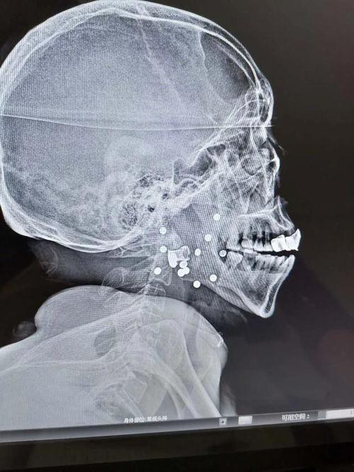 射脸上视频,揭秘射击技巧与战术解析