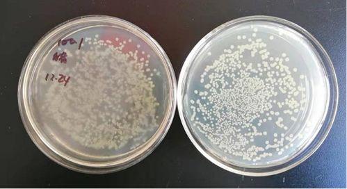 菌落总数测定视频,菌落总数测定方法与步骤详解