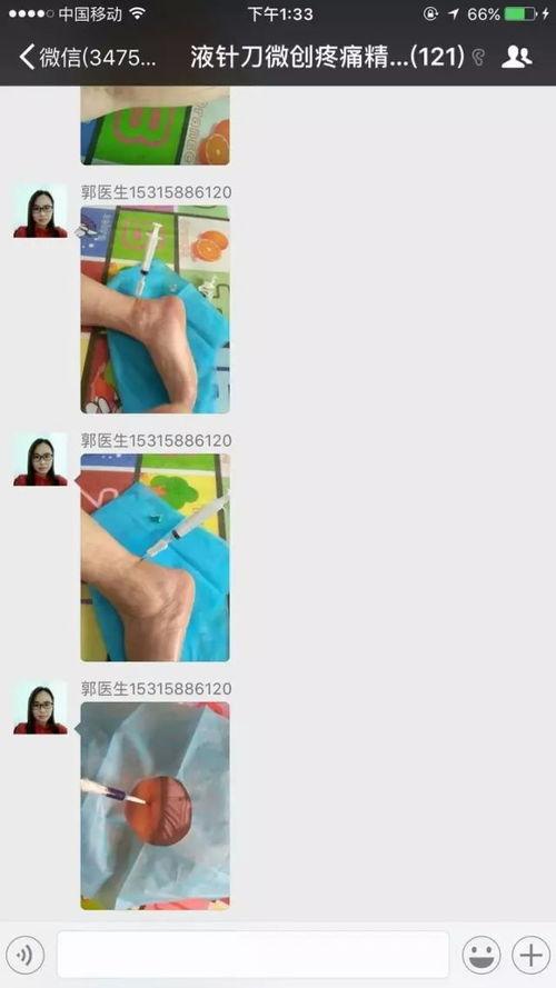 小针刀操作视频