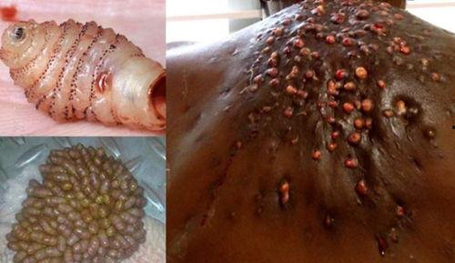 密集恐惧症视频,跟随视频探索微观世界中的恐惧之旅